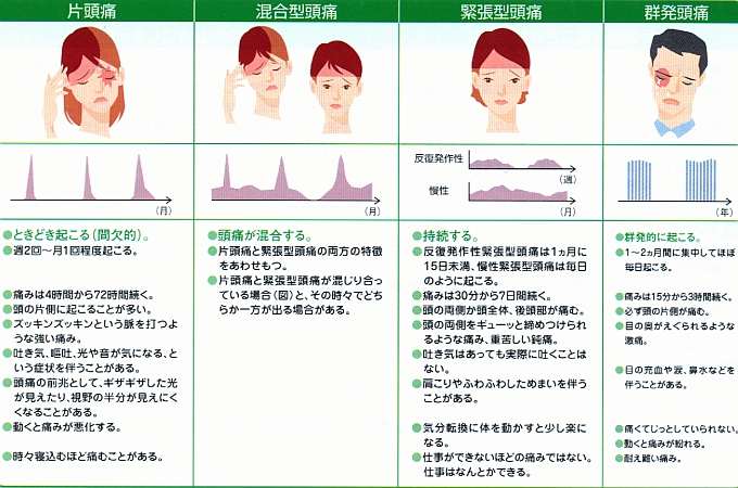 頭痛 寝 すぎ